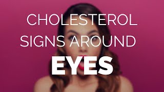 Cholesterol signs around eyes help and advice [upl. by Millian87]