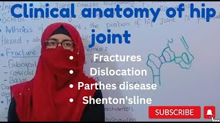 Clinical anatomy of hip joint  fractures dislocations perthes disease Shentons line lower limb [upl. by Brockwell]