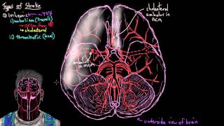 Khan Academy  Ischemic Stroke [upl. by Irek278]