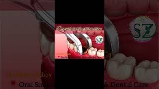 Tooth extraction decaid tooth tooth removal painlessdentistry dentalcare drrichadubey shorts [upl. by Hendrika]