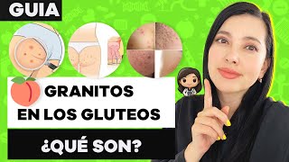 ¿Tienes GRANITOS en los GLÚTEOS TE CUENTO SOBRE FOLICULITIS [upl. by Biancha]