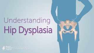 Understanding Hip Dysplasia  Boston Childrens Hospital [upl. by Assert]