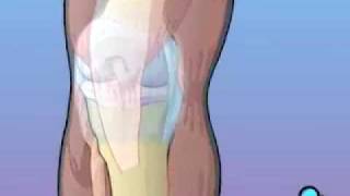 PreOp® Anterior Cruciate Ligament Patient Education [upl. by Fondea912]