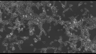 ZEISS Axio Observer HEK 293 cell culture longterm time lapse microscopy [upl. by Mur]