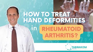 How To Treat Hand Deformities In Rheumatoid Arthritis Dr Hatem Eleishi [upl. by Assirahs]