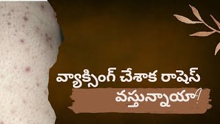 Waxing Rashes  post wax rash  how to Get rid off Waxing rashes in Telugu vijjis world [upl. by Letsirk]