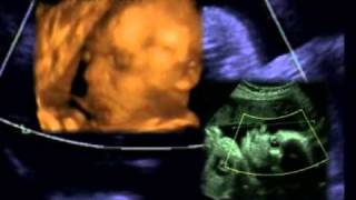 Ultrasound images of baby at 30 weeks of pregnancy [upl. by Anuqahs]