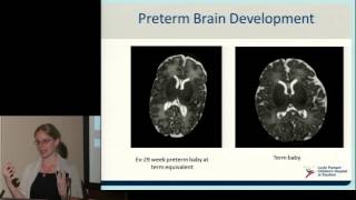 Neurodevelopment of Preterm Babies [upl. by Desberg]