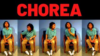 WHAT IS CHOREA Symptoms Causes Treatment [upl. by Adekam]