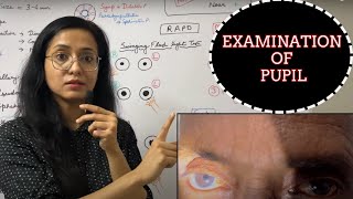 Examination Of Pupil  RAPD  Light Near Dissociation [upl. by Anav]