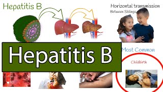 Hepatitis B symptoms treatment and prevention [upl. by Arataj752]