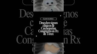 Signos clásicos de cardiopatías congénitas🫀🫁 en Rx de Tórax radiografia [upl. by Aynotahs]