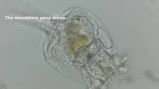 Brachionus Rotifer  The Basics [upl. by Weirick]