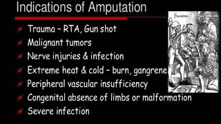 MSN Amputation Part1by Ms Mamta Singour MTCN Kumhari [upl. by Daphna]