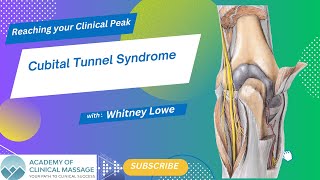 Cubital Tunnel Syndrome [upl. by Nomahs]