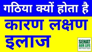 Arthritis Bimari Kya Hai Causes Symptoms Treatment Gathiya Rog Ke Lakshan ilaj Karan In Hindi [upl. by Zerlina545]