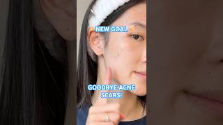 Ep 1  Clearing my ACNE SCARS by 2025 acnescars acnejourney skincare [upl. by Syxela]