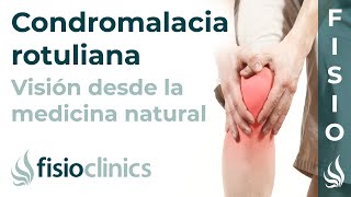 Condromalacia rotuliana o síndrome femoropatelar derecho Medicina natural  FisioClinics Palma [upl. by Bonney]