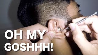 Mans Hard amp Dry Earwax Removal without applying Ear wax Softener [upl. by Nomyar]