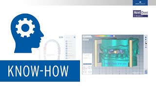 Simple amp intuitive – 3D Print meets dental workflow [upl. by Noevad]