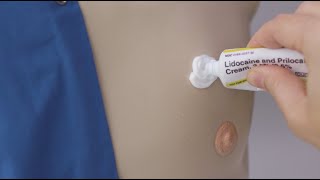 How to apply lidocaine cream to your port [upl. by Nobie77]