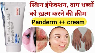 Panderm cream  Panderm cream Panderm cream use in Hindi  pendram cream ke fayde  shorts [upl. by Ediva]