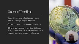 TONSILITIS ONLINE CLASS [upl. by Aneri]