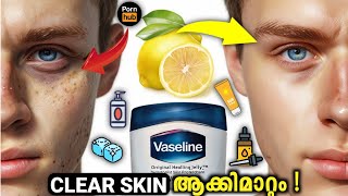 Skinnmaxxing Malayalam  lookmaxing 230clear skin [upl. by Naillimixam522]