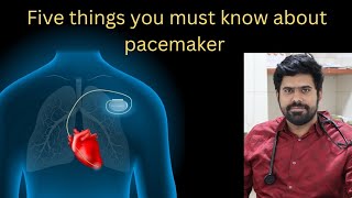 Five important facts about pacemakers you need to know  Doctor aditha cibi [upl. by Allegra]