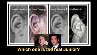 Ear study  David Quigley versus JohnJohn [upl. by Ahsie]