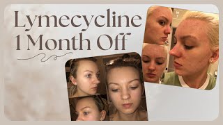 1 MONTH OFF LYMECYCLINE [upl. by Novj14]