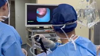 Clinical Application Of Geyi Endoscope Camera System [upl. by Ishmael961]