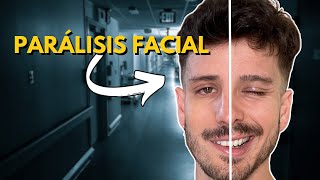 Qué Hacer si Tienes PARÁLISIS FACIAL  Tratamiento y Consejos [upl. by Anayad]