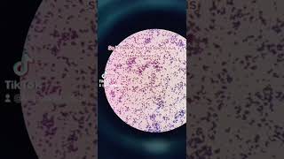 Gram positive cocci identification bacteria staphylococcus microscope [upl. by Hurleigh550]