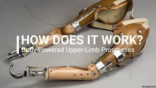 How Does a Body Powered Upper Limb Prostheses Work [upl. by Aneliram]