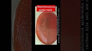 Staphylococcus epidermidis growth on various culture media wet mount and Gram Staining [upl. by Esinad15]