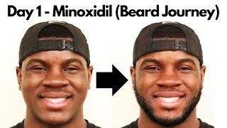 Day 1  Minoxidil Beard Growth Journey [upl. by Sivartal]