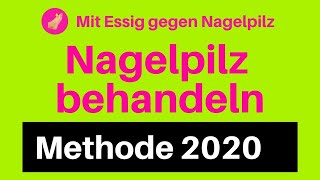 Nagelpilz Behandlung Essig gegen Nagelpilz 2020 entfernen loswerden [upl. by Douty]