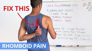 How to Fix Upper Back  Rhomboid Pain for GOOD 4 Effective Exercises [upl. by Annavaig400]