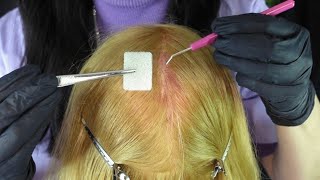 ASMR Bleach Fail  Scalp Check amp First Aid Treatment Whispered [upl. by Ahab]