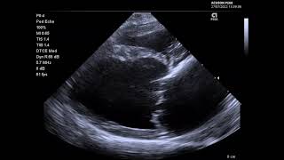 Siemens P500 case example canine mitral regurgitation [upl. by Juni]