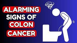 8 Warning Signs of COLON CANCER you Shouldnt Ignore  Nourish Hub [upl. by Atoiganap671]