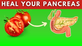 20 Best Foods For Pancreatitis Heal Pancreas Naturally [upl. by Yelbmik65]