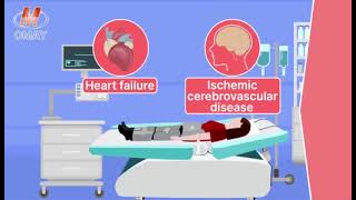 EECPa noninvasive and US FDA approved treatment for ischemic heart diseases [upl. by Kensell]