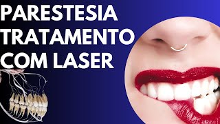 Parestesia e laserterapia [upl. by Ahsa]