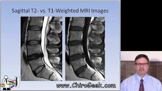 Dr Gillard lectures on How to Read Your Lumbar MRI [upl. by Fenn317]