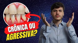 Saiba diferenciar  Periodontite Agressiva x Crônica Periodontia [upl. by Sheree]