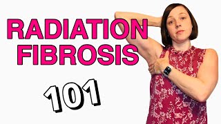 Radiation Fibrosis Side Effect  What You Need to Know [upl. by Crocker]