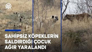 Sahipsiz köpeklerin saldırdığı çocuk ağır yaralandı [upl. by Oiramd]