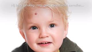 Ouders van Kees delen pijn zorgen hoop en liefde in ontroerende video over diagnose FOXG1 syndroom [upl. by Renae424]